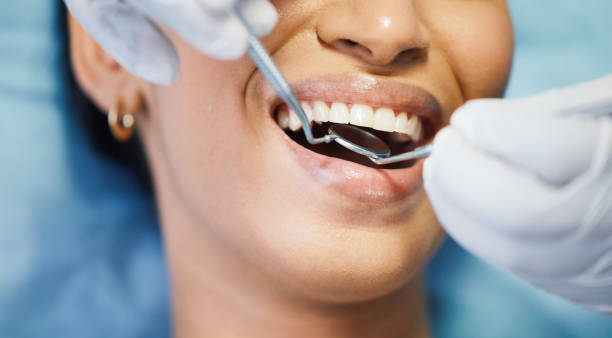Best Knocked-Out Tooth Emergency  in Greenwood, DE